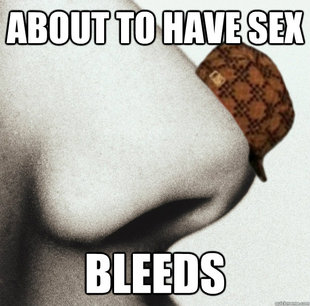 Scumbag Nose