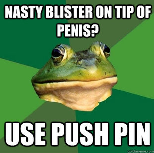 Foul Bachelor Frog