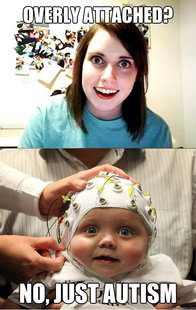 overly attached baby