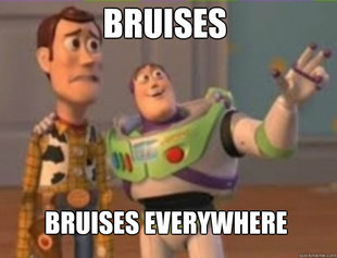 buzz lightyear
