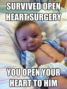 Ridiculously Goodlooking Surgery Baby