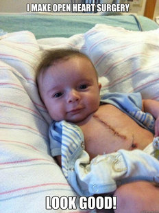 Ridiculously Goodlooking Surgery Baby
