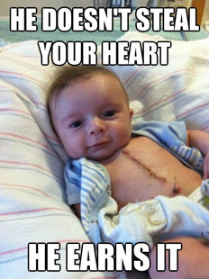 Ridiculously Goodlooking Surgery Baby