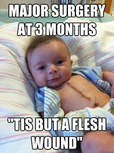 Ridiculously Goodlooking Surgery Baby