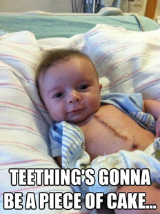 Ridiculously Goodlooking Surgery Baby