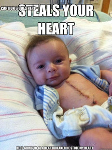 Ridiculously Goodlooking Surgery Baby