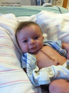 Ridiculously Goodlooking Surgery Baby