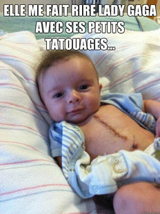 Ridiculously Goodlooking Surgery Baby