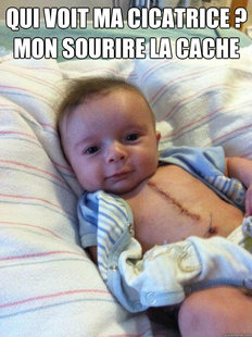 Ridiculously Goodlooking Surgery Baby