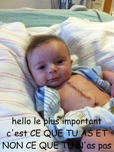 Ridiculously Goodlooking Surgery Baby