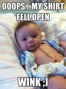 Ridiculously Goodlooking Surgery Baby