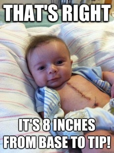 Ridiculously Goodlooking Surgery Baby