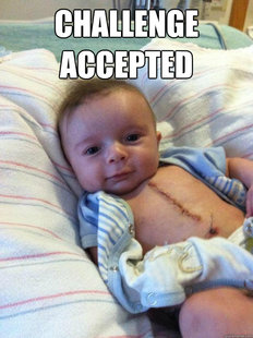 Ridiculously Goodlooking Surgery Baby