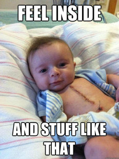 Ridiculously Goodlooking Surgery Baby