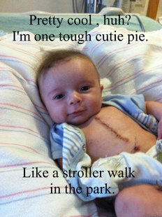 Ridiculously Goodlooking Surgery Baby