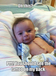 Ridiculously Goodlooking Surgery Baby
