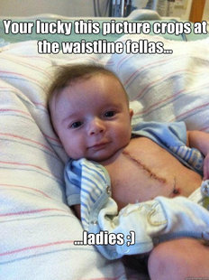 Ridiculously Goodlooking Surgery Baby