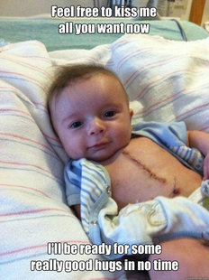 Ridiculously Goodlooking Surgery Baby