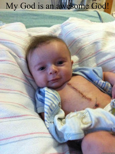 Ridiculously Goodlooking Surgery Baby