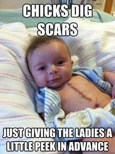 Ridiculously Goodlooking Surgery Baby