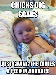 Ridiculously Goodlooking Surgery Baby