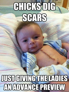 Ridiculously Goodlooking Surgery Baby
