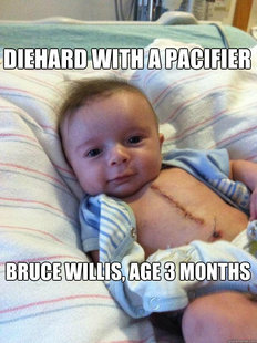 Ridiculously Goodlooking Surgery Baby