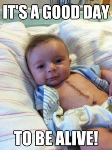 Ridiculously Goodlooking Surgery Baby