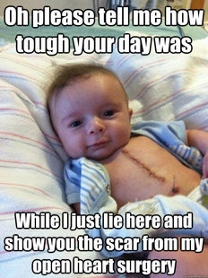 Ridiculously Goodlooking Surgery Baby