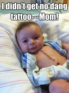 Ridiculously Goodlooking Surgery Baby