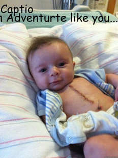Ridiculously Goodlooking Surgery Baby
