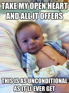 Ridiculously Goodlooking Surgery Baby