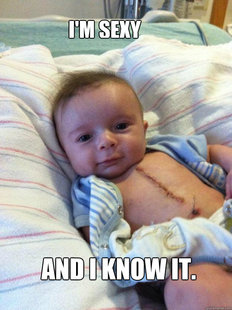 Ridiculously Goodlooking Surgery Baby
