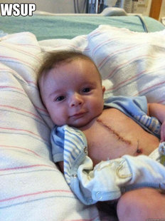 Ridiculously Goodlooking Surgery Baby