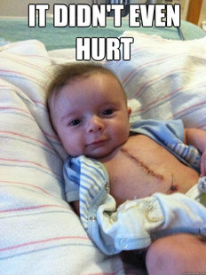 Ridiculously Goodlooking Surgery Baby