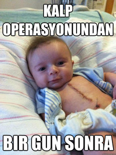 Ridiculously Goodlooking Surgery Baby