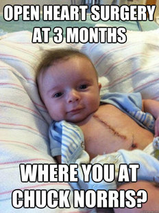 Ridiculously Goodlooking Surgery Baby