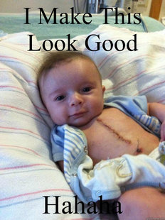 Ridiculously Goodlooking Surgery Baby