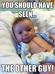 Ridiculously Goodlooking Surgery Baby