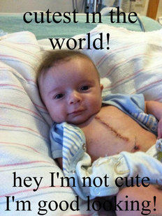 Ridiculously Goodlooking Surgery Baby