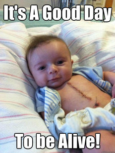 Ridiculously Goodlooking Surgery Baby