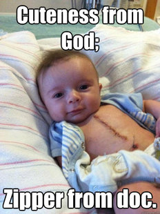 Ridiculously Goodlooking Surgery Baby