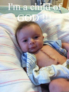 Ridiculously Goodlooking Surgery Baby