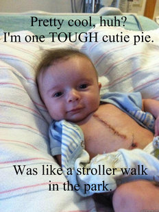 Ridiculously Goodlooking Surgery Baby