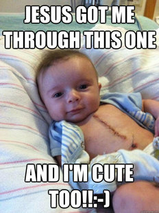 Ridiculously Goodlooking Surgery Baby