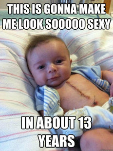 Ridiculously Goodlooking Surgery Baby