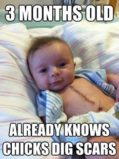 Ridiculously Goodlooking Surgery Baby