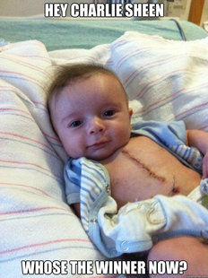 Ridiculously Goodlooking Surgery Baby