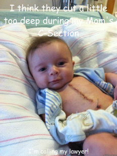 Ridiculously Goodlooking Surgery Baby