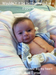 Ridiculously Goodlooking Surgery Baby